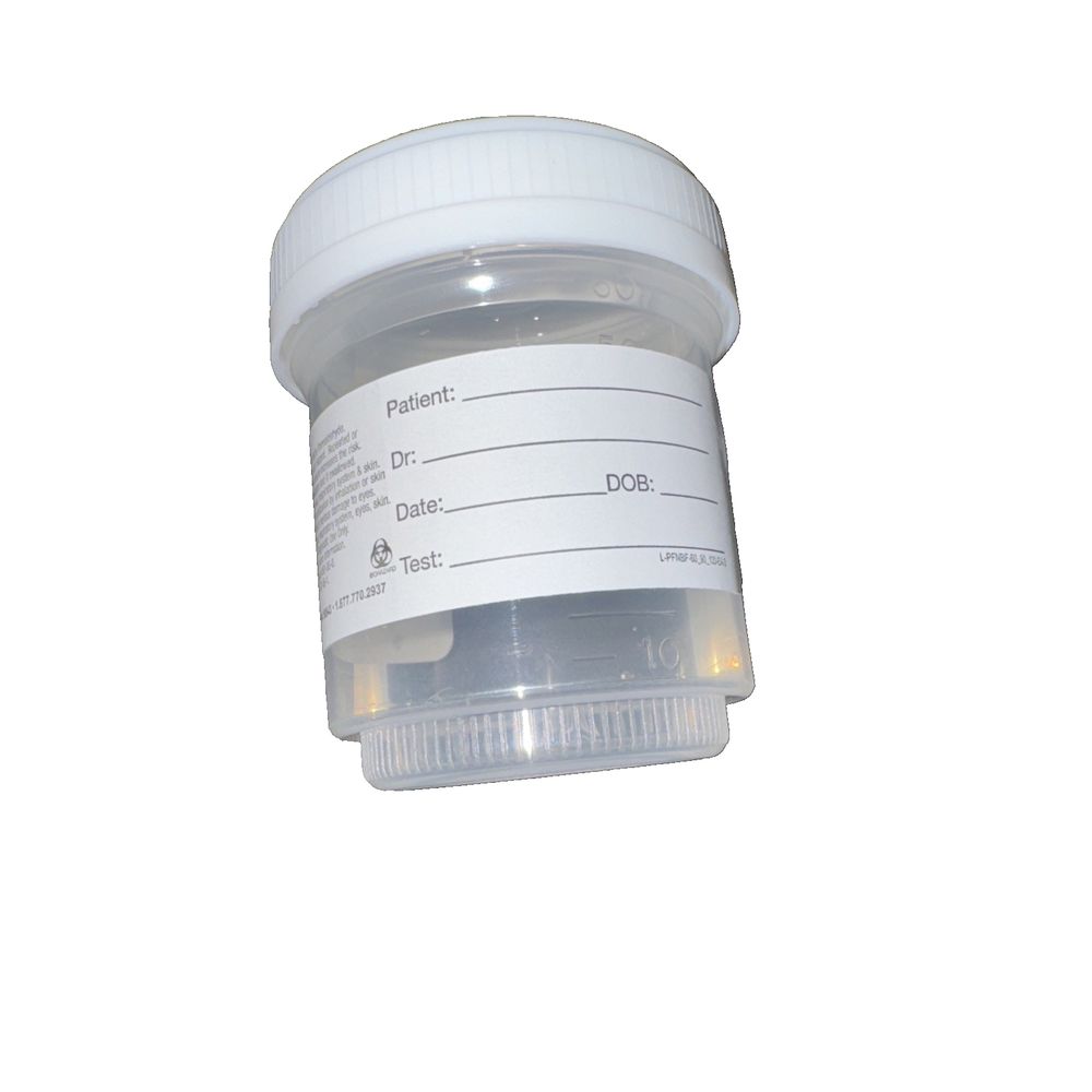 Prefilled Formalin 60 ML/ Half Filled 51 Total Vials, Azer Scientific – a bottle of urine with a white lid