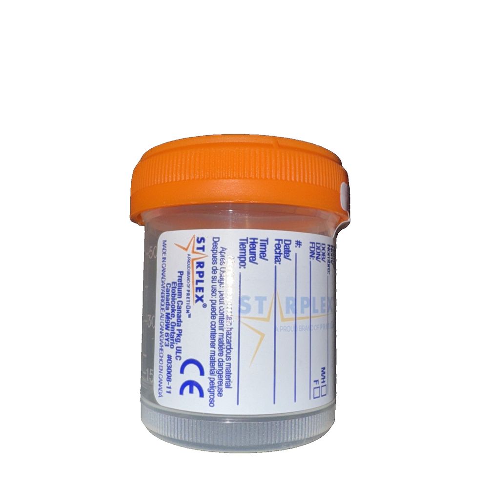 CONTAINER SPECIMEN 60ml Sterile ORANGE O-RING CAP/TAB LABEL 100 Pack, DaveyDooDeals – a bottle of orange colored paint