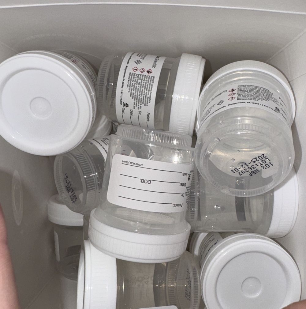 Prefilled Formalin 60 ML/ Half Filled 51 Total Vials, Azer Scientific – a person holding a box of pills
